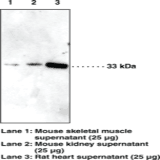 IGFBP5 Polyclonal Antibody avatar