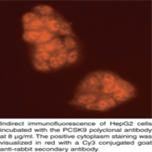 PCSK9 (mouse) Polyclonal Antibody