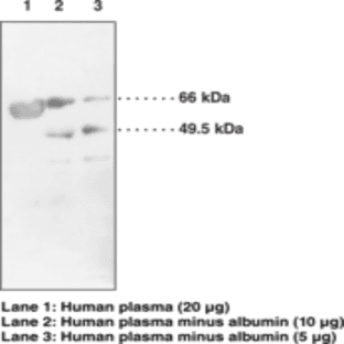 LCAT Polyclonal Antibody avatar