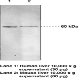 Soluble Epoxide Hydrolase Polyclonal Antibody