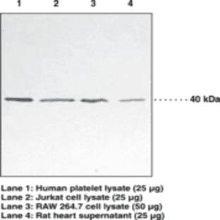 p38 MAPK Monoclonal Antibody (Clone 9F12)