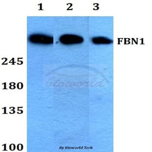 FBN1 (N2843) pAb avatar