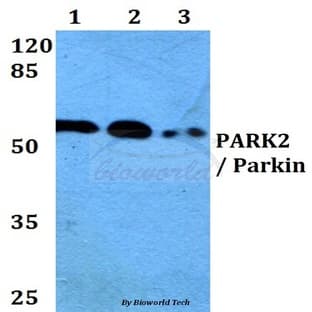 PARK2 / Parkin (T125) pAb avatar