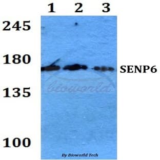 SENP6 (K1077) pAb avatar