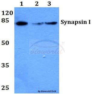 Synapsin I (T56) pAb avatar