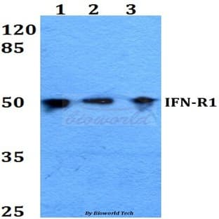 IFN-R1 (L461) pAb avatar