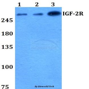 IGF-2R (F2480) pAb avatar