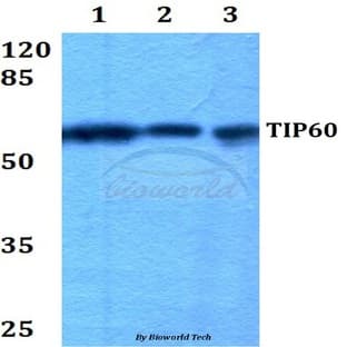 TIP60 (G82) pAb avatar