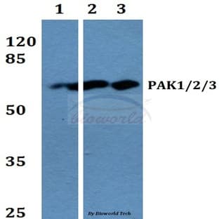 PAK1/2/3 (K140) pAb avatar