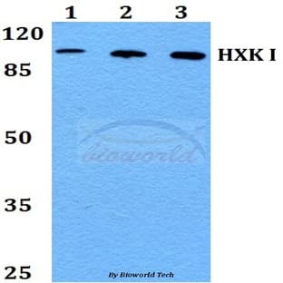 HXK I (F67) pAb avatar