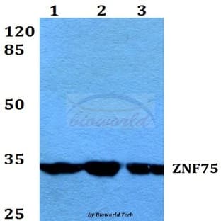 ZNF75 (K107) pAb avatar