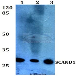 SCAND1 (E88) pAb avatar
