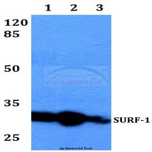 SURF-1 (F181) pAb avatar