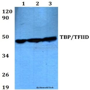 TBP (A184) pAb avatar