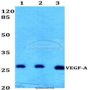 VEGF-A (R131) pAb avatar