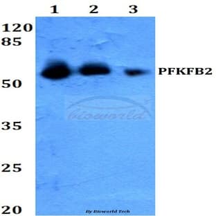 PFKFB2 (Y14) pAb avatar