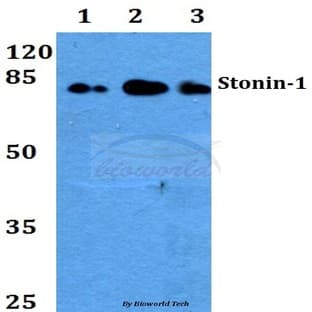 Stonin-1 (W718) pAb avatar