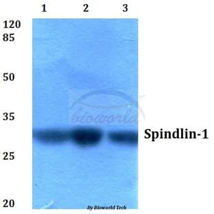 Spindlin-1 (H139) pAb avatar