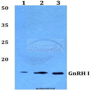 GnRH I (D43) pAb avatar