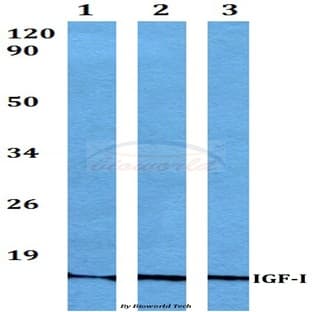 IGF-1 (K149) pAb avatar