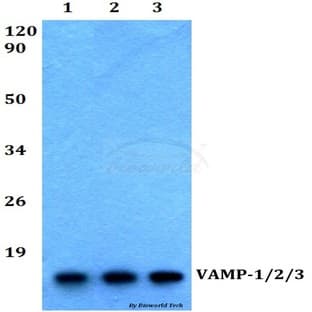 VAMP-1/2/3 (D70) pAb avatar