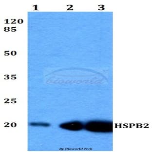 HSPB2 (N143) pAb avatar