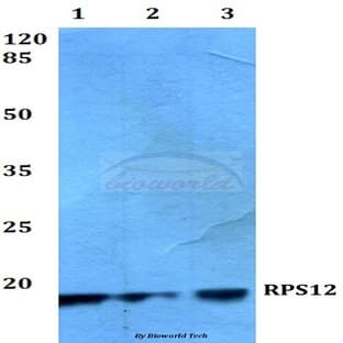 RPS12 (E125) pAb avatar