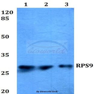 RPS9 (E73) pAb avatar