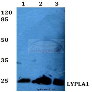 LYPLA1 (K90) pAb avatar