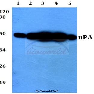 uPA (L239) pAb avatar