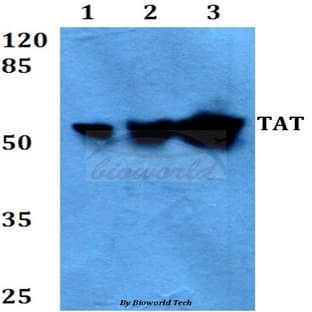 TAT (E304) pAb avatar
