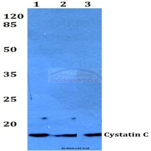 Cystatin C (F122) pAb avatar