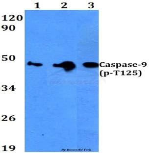 p-Caspase-9 (T125) pAb avatar