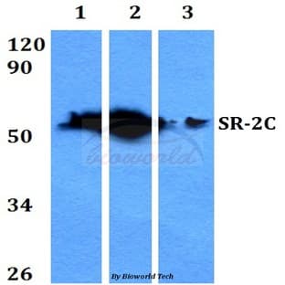 SR-2C (P190) pAb avatar