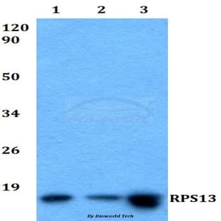 RPS13 (L115) pAb avatar