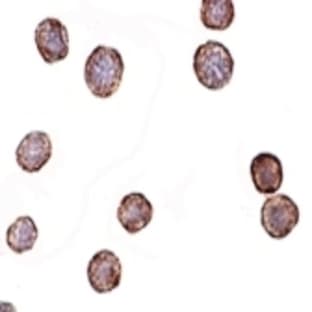 anti-CXCR4-Lo (N-Term) antibody avatar