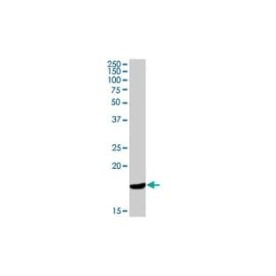 anti-Cathelicidin Antimicrobial Peptide (cAMP) antibody