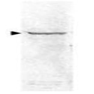 anti-Nuclear Factor-KB P65 (NFkBP65) (C-Term) antibody