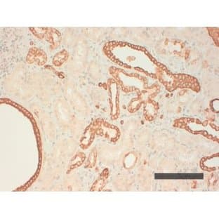 anti-Cytokeratin AE1 antibody avatar