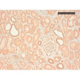 anti-Cytokeratin (Keratin) Type II antibody avatar