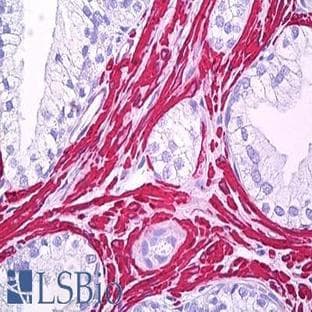 anti-Actin, alpha 2, Smooth Muscle, Aorta (ACTA2) antibody avatar