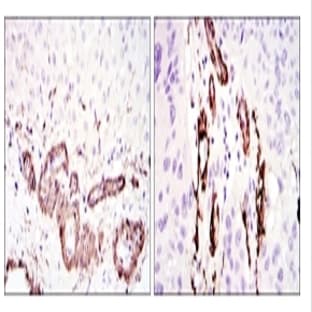 anti-ACTA2 / Aortic Smooth Muscle Actin antibody avatar