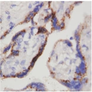 anti-Chorionic Gonadotropin (hCG) antibody avatar