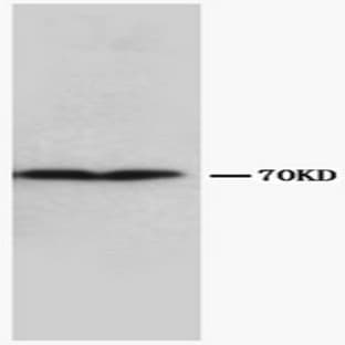 anti-Collagen Type III alpha 1 Chain (Chain alpha 1) antibody avatar