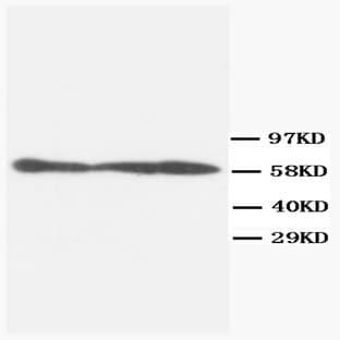 anti-PPP3CA / Calcineurin A antibody avatar