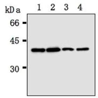 anti-Recombinase A / RecA antibody avatar