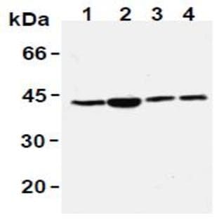anti-Recombinase A / RecA antibody avatar