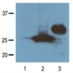 anti-RFP-Tag (N-Term) antibody avatar