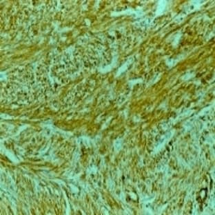 anti-ACTA2 / Aortic Smooth Muscle Actin (N-Term) antibody