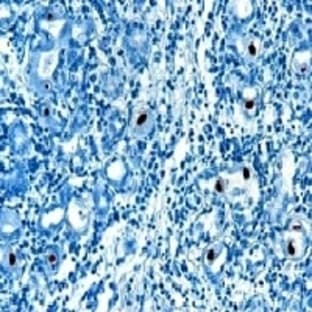 anti-Cytomegalovirus (CMV) antibody avatar